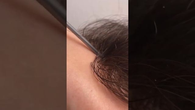 Как скрыть облысение? Посмотри информацию о мужской системе волос) Ссылка в профиле ? смотреть онлайн