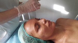 Ретиноевый пилинг