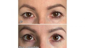 фото до и после