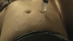 укол в живот