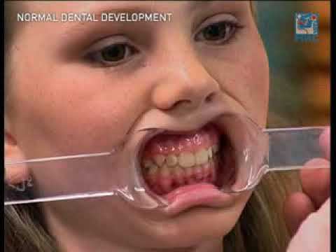 Развитие ЗЧС в норме смотреть онлайн