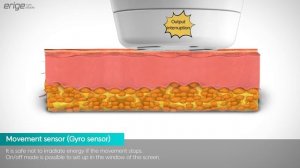 ERIGEN : The Korea Latest Synchronization of HIFU+RF