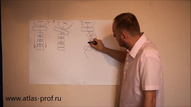 Остеохондроз шейного отдела позвоночника