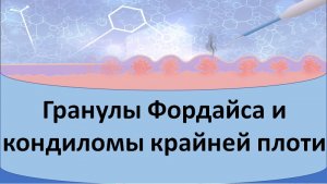 Гранулы Фордайса и кондиломы
