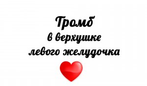 Тромб в верхушке левого желудочка на эхокардиографии