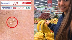 БЕЛЫЕ ПРЫЩИ, ЖИРОВИКИ НА ЛИЦЕ  Как я снизила холестерин в крови без лекарств  POLI NA PALME
