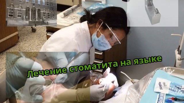 Лечение стоматита на языке