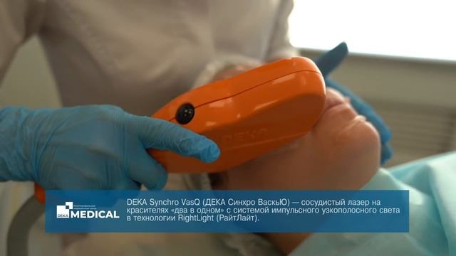 Фотоомоложение | DEKA Synchro VasQ смотреть онлайн