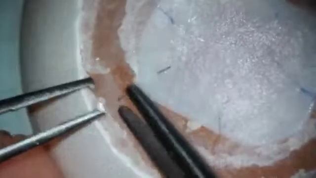 Тренировка хирурга смотреть онлайн