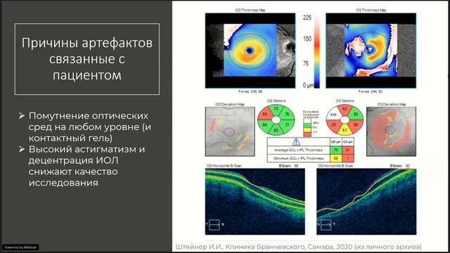 Цикл лекций по ОКТ при глаукоме. Повторяемость и воспроизводимость