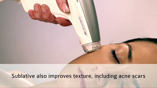 NUVAGE TREATMENT LOOP V1_6 смотреть онлайн