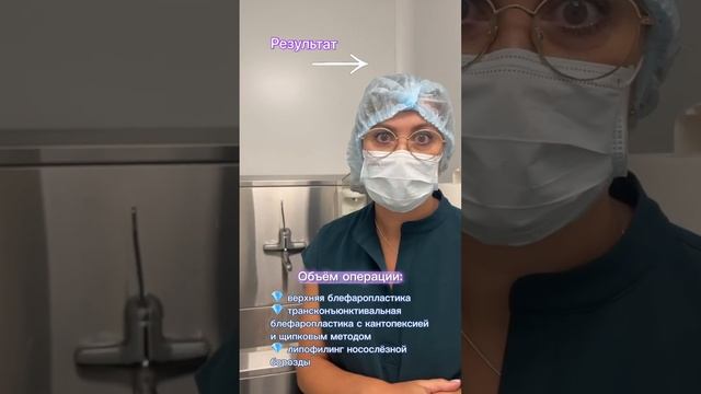 Круговая блефаропластика смотреть онлайн