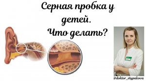 Серная пробка в ухе у детей.Что делать? Симптомы и лечение.Капли в ухо для раздражения серы.