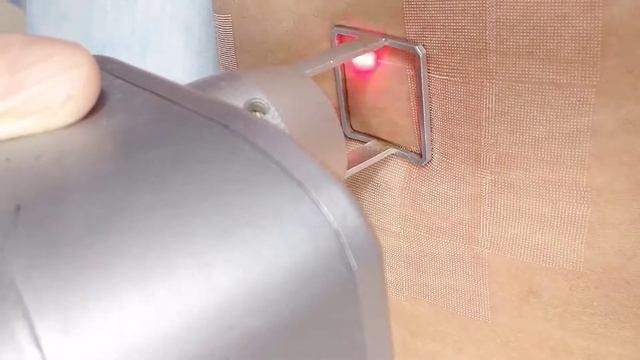 Лечение стрий и растяжек лазером смотреть онлайн