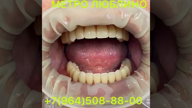 Стоматология 24 (ч) Москва.М.Люблино.У.Белореченская 5 #мусофир #стоматологиямосква #москва #узбек