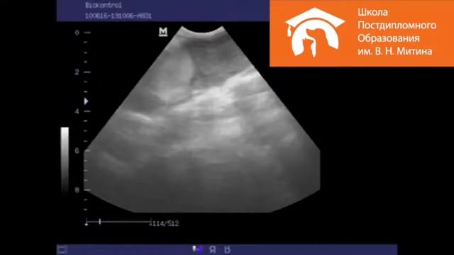 Новообразование почки смотреть онлайн