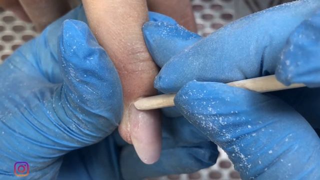 "БЕТОННЫЙ" Маникюр. Сложная коррекция гелем/ПОДНЯТИЕ КЛЮЮЩИХ и достроение параллелей.