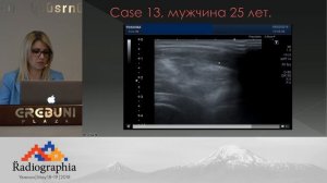 Особенности УЗИ-диагностики плечевого сустава. Мастер-класс