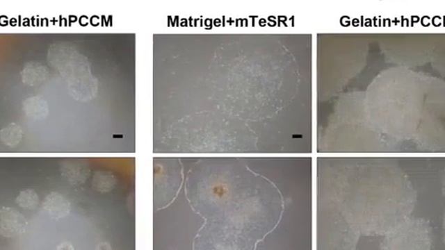 Pluripotent Stem Cell Propagation on Gelatin in Placenta-like Media | Protocol Preview смотреть онлайн