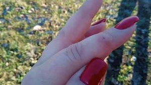 От чего у меня шишка на пальце