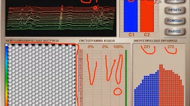 Результаты применения ионизатора Сферион часть 3