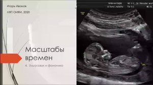 И.Иванов Лекция 4. "Ультразвук и фононика" / I.Ivanov Lecture 4. "Ultrasound and phononics"