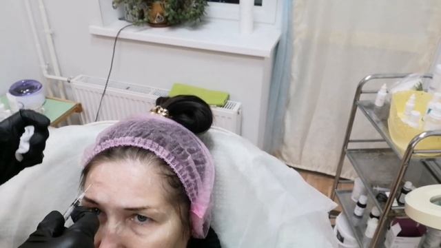 Еду к косметологу! Процедура Диспорт! смотреть онлайн