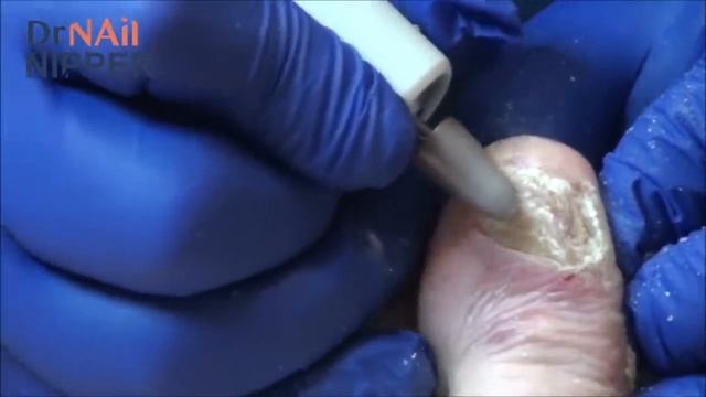 Bunions and Calluses (and Dogs) [Throwback Thursday] смотреть онлайн