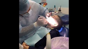 Удаление молочного зуба