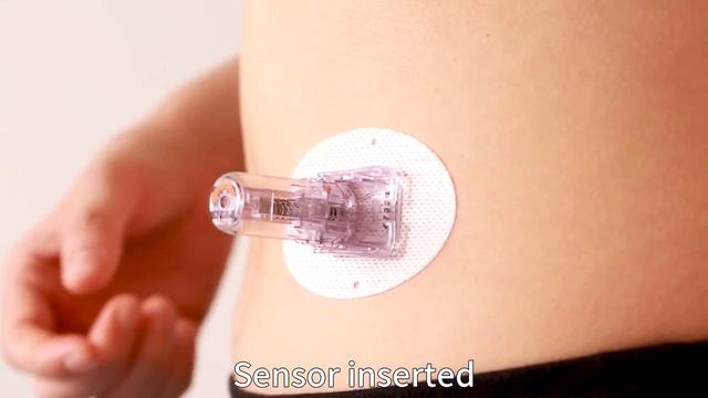 Видеоинструкция установки новой системы мониторинга глюкозы в крови MEDTRUM S7 EasySense® CGM Syste смотреть онлайн