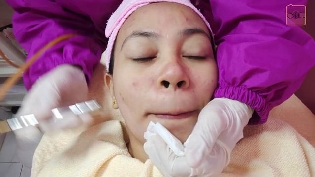 What is Diamond Peel | My First Diamond Peel Experience featuring SKIN 911 | Maistrang Laagan смотреть онлайн