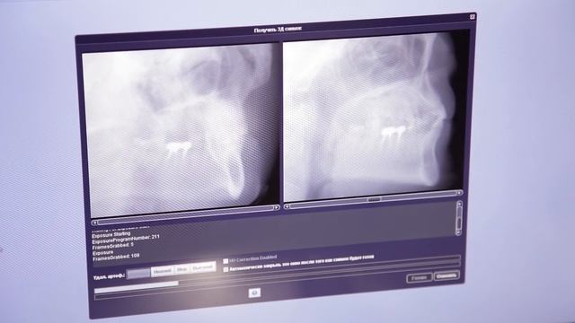 Компьютерная томография. Медсемья о компьютерной томографии и ортопантомограмме.