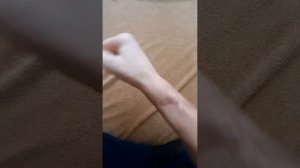 ложный сустав лучевой кости.