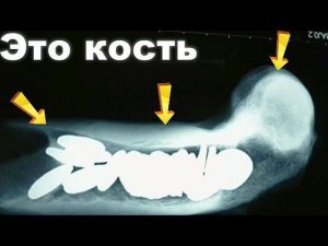 ПАРЕНЬ УМОЛЯЛ ВРАЧЕЙ СДЕЛАТЬ ЕМУ РЕНТГЕН.