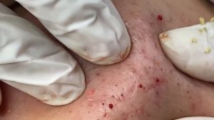 Satisfying and Relaxation with SURI NGUYEN Beauty Spa Video #206