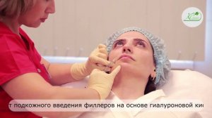 Коррекция носогубных складок филлерами в Клинике "Косметик центр"