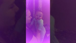 Синдром Дауна 6 месяцев
