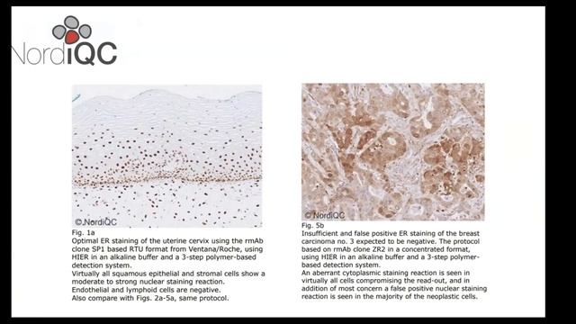 Иммуногистохимическое исследование (ИГХ) для онколога. Часть I
