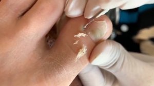 How to Repair Nails easy # 469 - Xuyen Nail