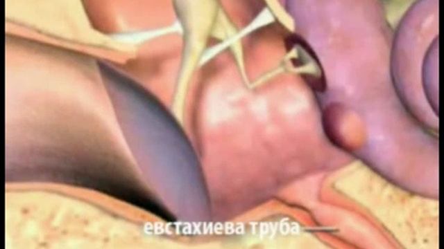 средний отит смотреть онлайн