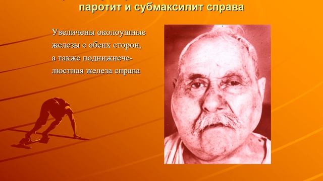 Острые и хронические сиаладениты. Часть 1. смотреть онлайн