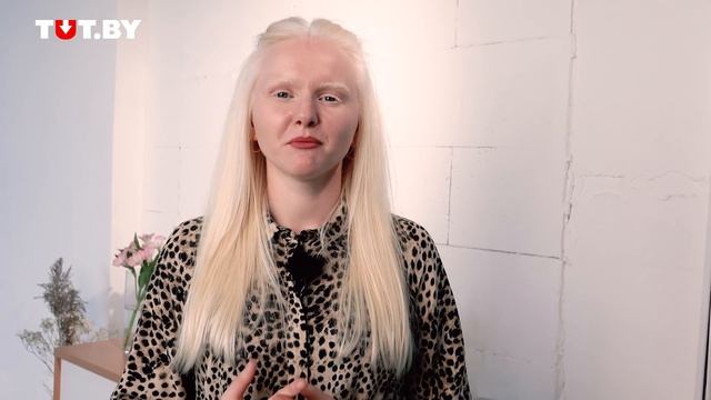 Альбинос: Катя | Быть молодым смотреть онлайн