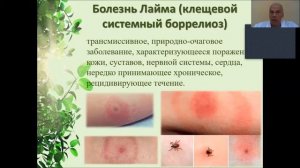 Клещевые инфекции