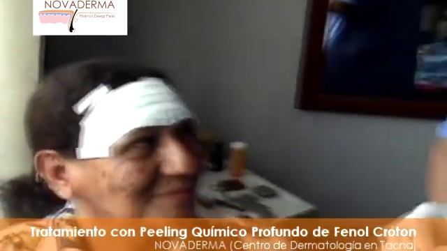 Tratamiento con Fenol - Última Parte смотреть онлайн