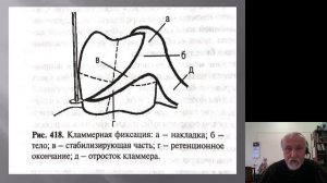 Простое протезирование. Параллелометрия