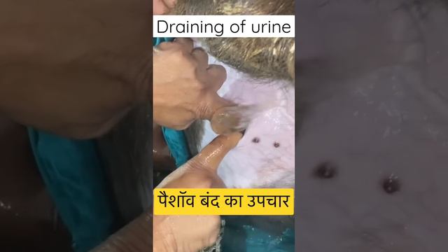 Retention of urine l Dr umar khan