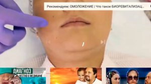 Коррекция губ. Как правильно увеличить губы!