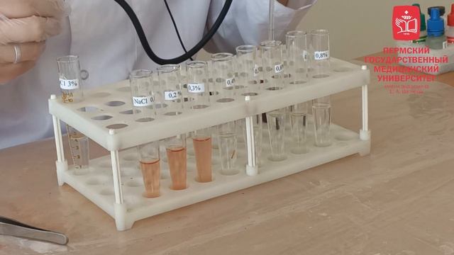 Определение осмотической резистентности эритроцитов