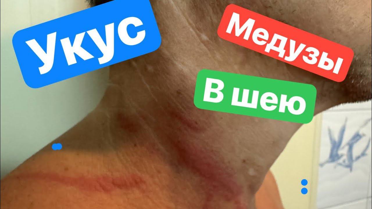 МЕНЯ УЖАЛИЛА МЕДУЗА! смотреть онлайн