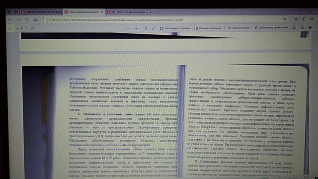 Грудная полость #2 смотреть онлайн